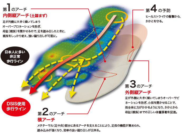 アーチサポートで正しい体重移動で歩行