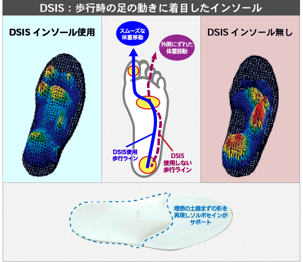 ３つのアーチサポートを目的にしたインソール