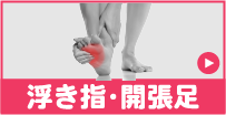 サポーター選び方：浮き指開張足