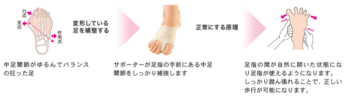 外反母趾サポーター おすすめ
