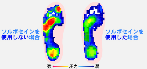 体圧分散性能が凄い！